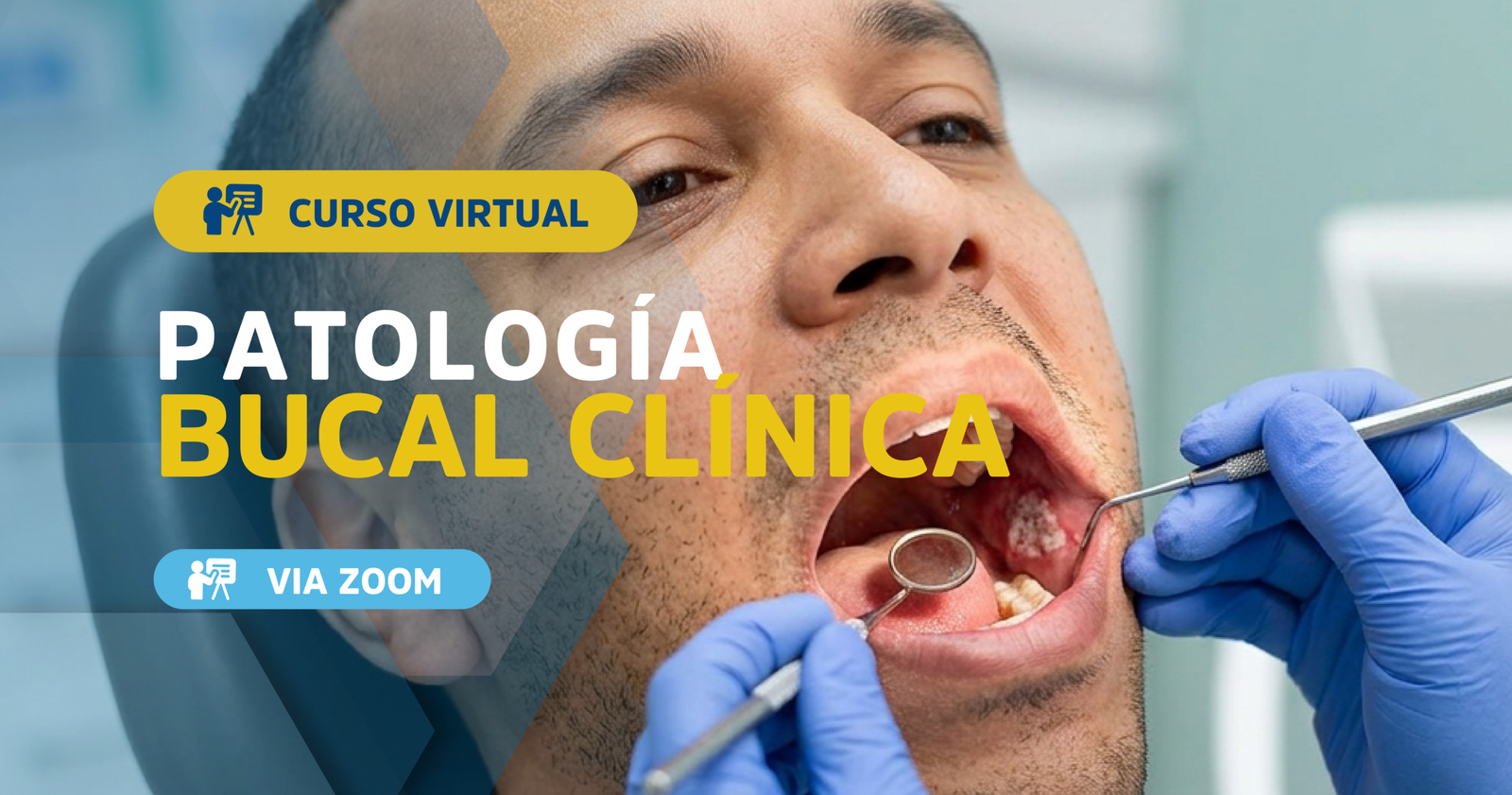 Patología Bucal Clínica
